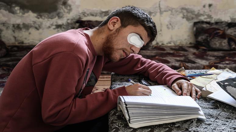 الطالب حمزة الحشاش، (20 عاما)، يواصل دراسته الجامعية في قطاع غزة بعد أن فقد عينه اليمنى وأصيب بجروح خطيرة جراء غارة جوية إسرائيلية استهدفت منزل عمه في مخيم البريج وسط القطاع 