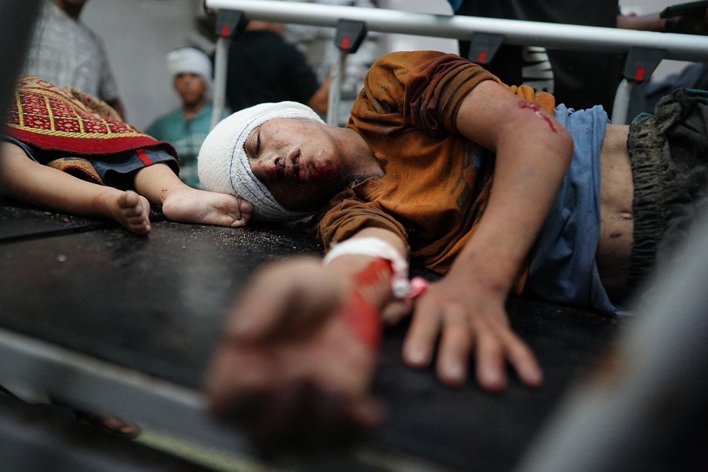 طفل جريح يتلقى العلاج في مجمع ناصر الطبي في خان يونس جنوب قطاع غزة (أ ف ب)