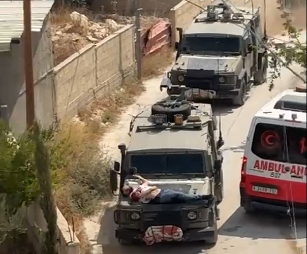 الاحتلال يصيب شابا من مدينة جنين وينكل به ويضعه على مقدمة جيب عسكري 