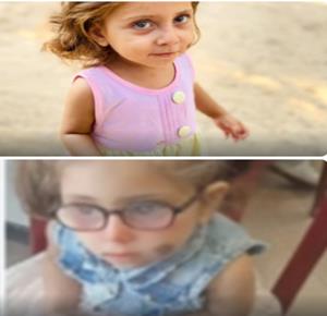 الطفلة سيلا قبل وبعد تدهور نظرها