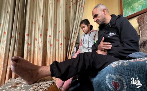 أحمد يأمل باستعادة جزء من بصره الذي فقده بغارة إسرائيلية