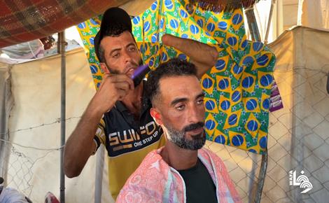 جهاد يواصل مهنة الحلاقة رغم بتر يده