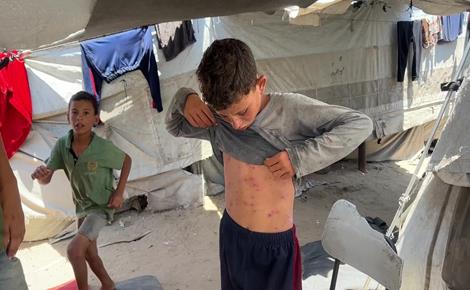الحرّ يفاقم معاناة النازحين على شاطئ غزة
